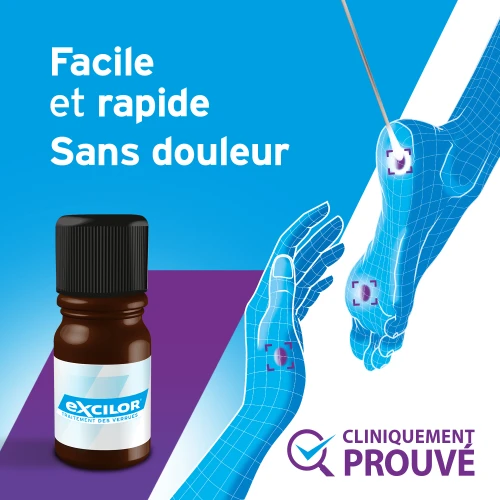 Traitement des verrues (TCA gel)