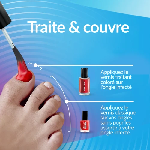  Mycose de l'ongle Forte Color