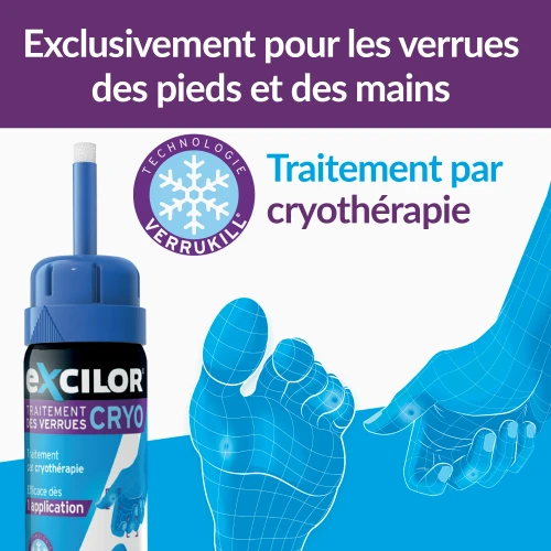 Traitement des verrues Cryo