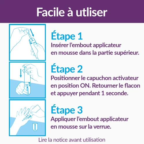 Traitement des verrues Cryo