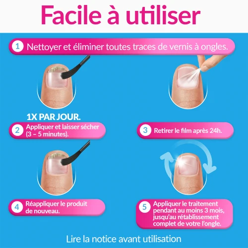 Traitement de la Mycose de l'Ongle Forte