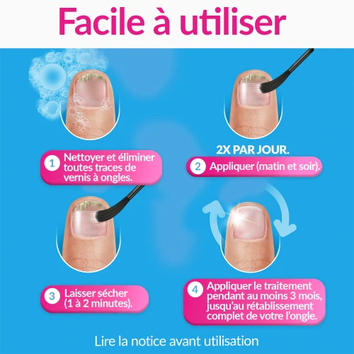 Solution Traitement de la Mycose de l'Ongle