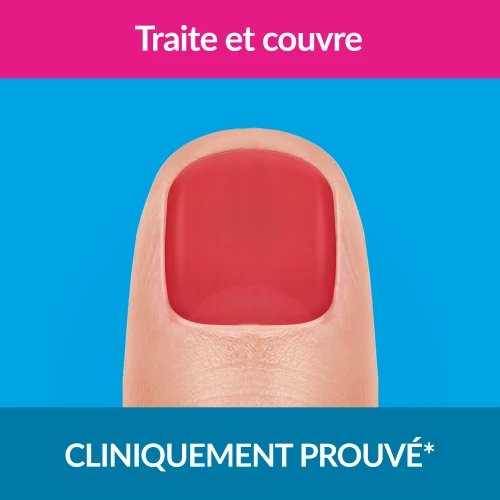 Traitement Forte Color Rouge